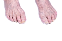 The Characteristics of Elderly Feet