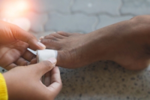 How to Manage Blisters on the Feet