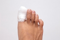 When to See the Podiatrist for a Broken Toe